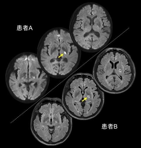 fig.1