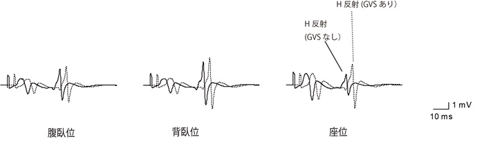 fig.1