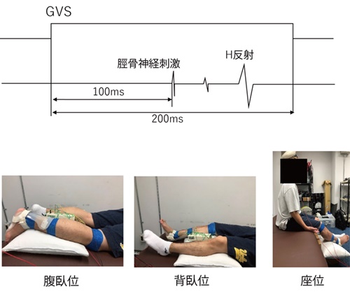 fig.1